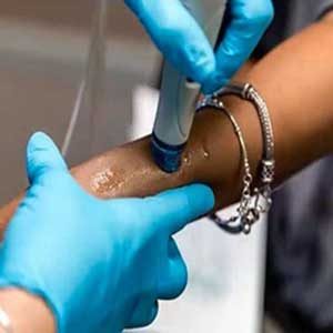 hair removal waxing
